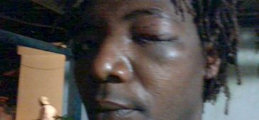 05122012_agressao_norte_reprod.jpg