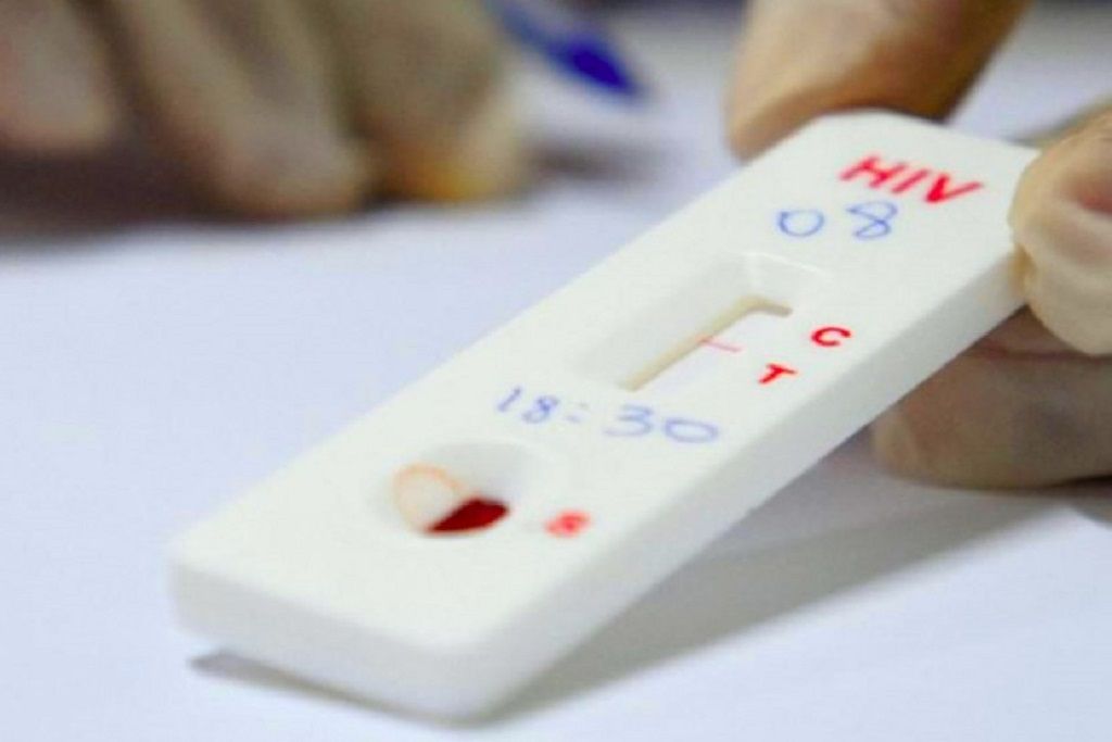 teste_hiv_FotoAssembleiaLegislativaCE.jpg