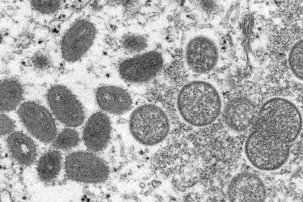 variola-do-macacoagenciabrasil-1.jpg