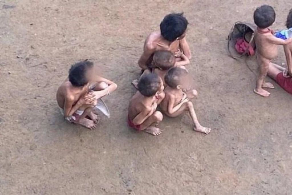 criancas_yanomami_desnutricao_divulgacao_condisi_yy.jpg